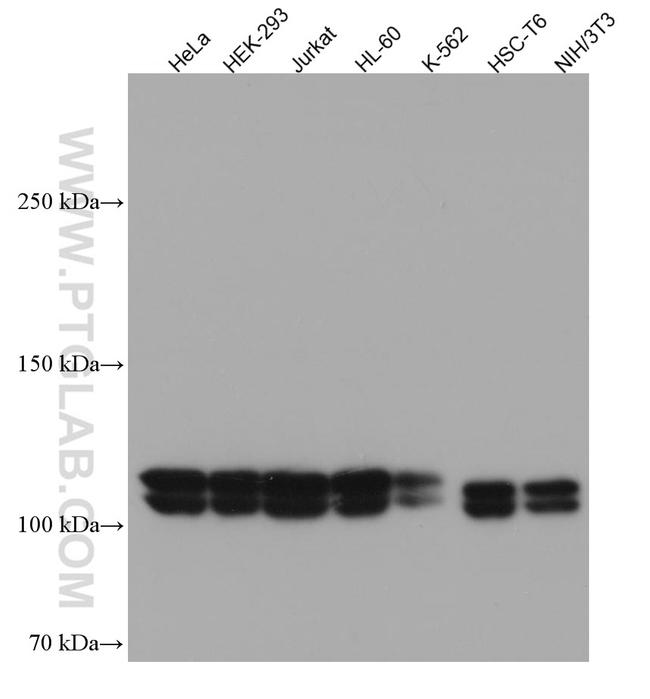 UBE1 Antibody in Western Blot (WB)