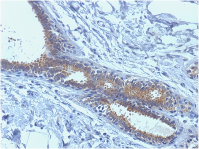 BRCA1 (Breast Marker) Antibody in Immunohistochemistry (Paraffin) (IHC (P))