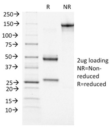 BRCA1 (Breast Marker) Antibody in SDS-PAGE (SDS-PAGE)
