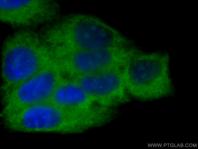 SBDS Antibody in Immunocytochemistry (ICC/IF)