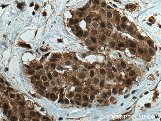 SBDS Antibody in Immunohistochemistry (Paraffin) (IHC (P))