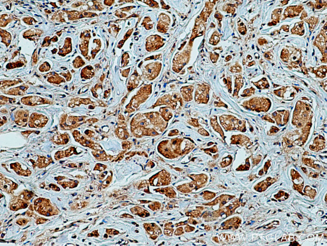 PEPD Antibody in Immunohistochemistry (Paraffin) (IHC (P))