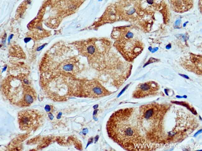 PEPD Antibody in Immunohistochemistry (Paraffin) (IHC (P))