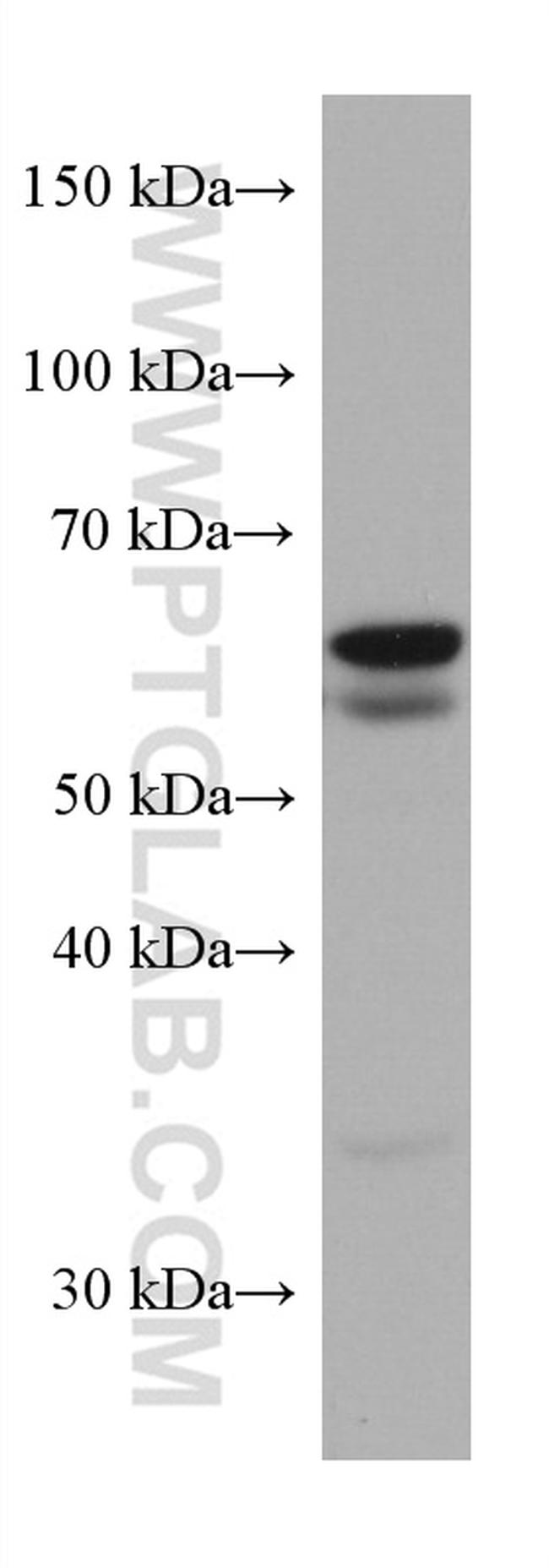 SQLE Antibody in Western Blot (WB)