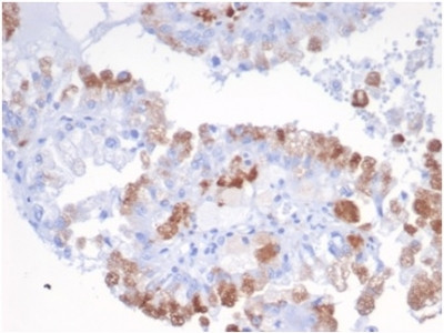 SREBP2 (Transcription Factor) Antibody in Immunohistochemistry (Paraffin) (IHC (P))