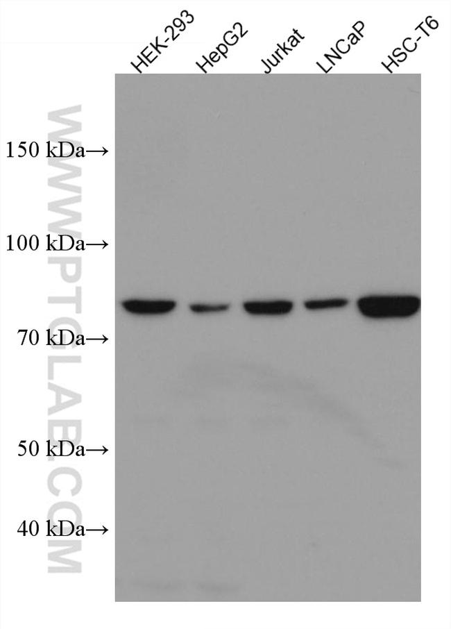 TBK1 Antibody in Western Blot (WB)