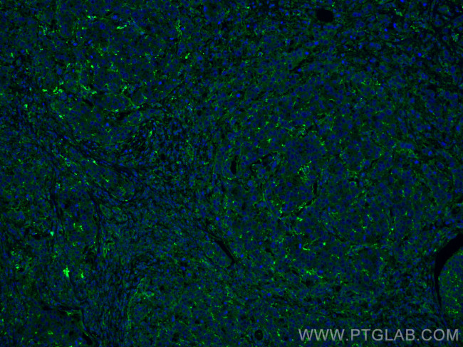 BCAR1 Antibody in Immunohistochemistry (Paraffin) (IHC (P))