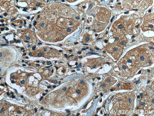 BCAR1 Antibody in Immunohistochemistry (Paraffin) (IHC (P))