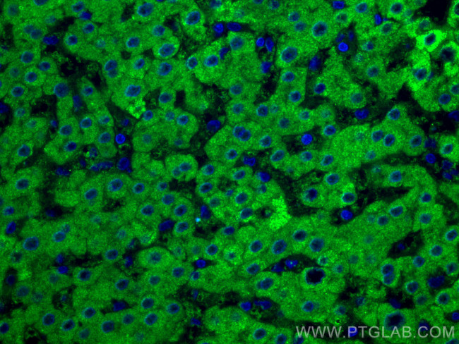 GCK Antibody in Immunohistochemistry (Paraffin) (IHC (P))