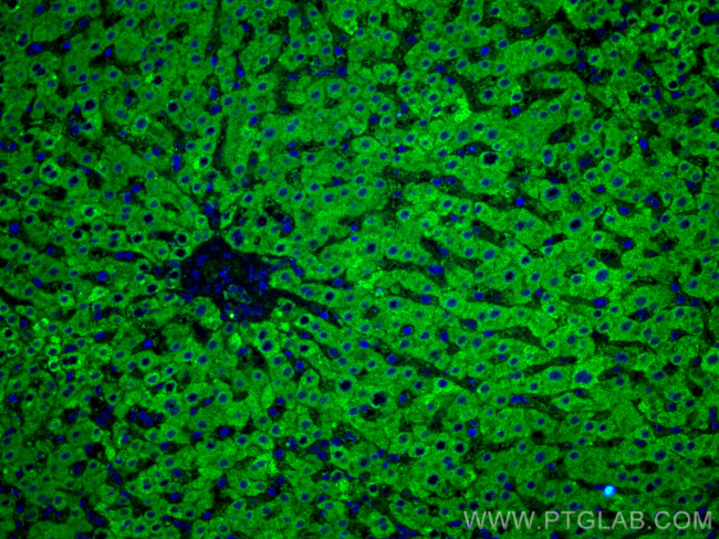 GCK Antibody in Immunohistochemistry (Paraffin) (IHC (P))