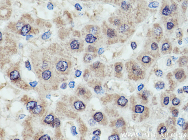 GCK Antibody in Immunohistochemistry (Paraffin) (IHC (P))