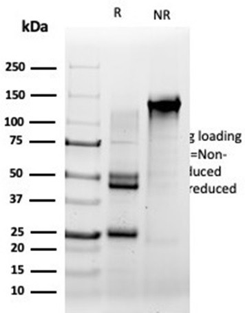 Serum Response Element Binding Transcription Factor (SRF) Antibody in SDS-PAGE (SDS-PAGE)