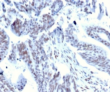 Serum Response Element Binding Transcription Factor (SRF) Antibody in Immunohistochemistry (Paraffin) (IHC (P))