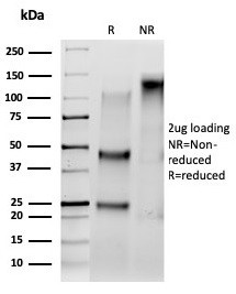 Serum Response Element Binding Transcription Factor (SRF) Antibody in SDS-PAGE (SDS-PAGE)