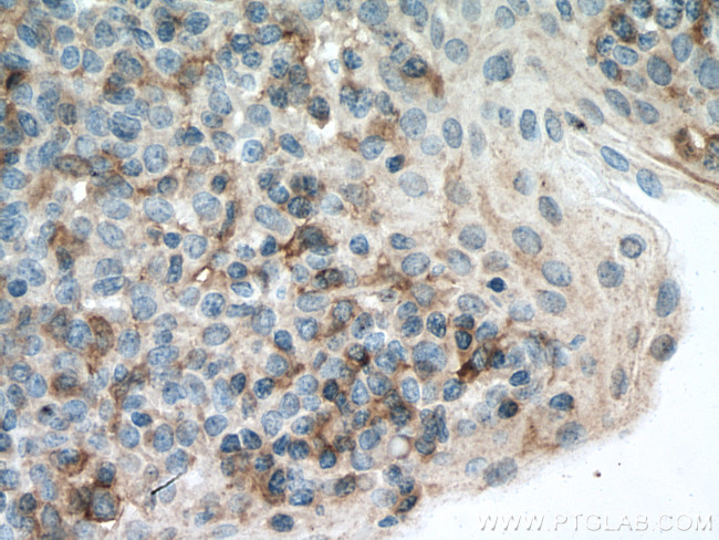 LAIR1 Antibody in Immunohistochemistry (Paraffin) (IHC (P))