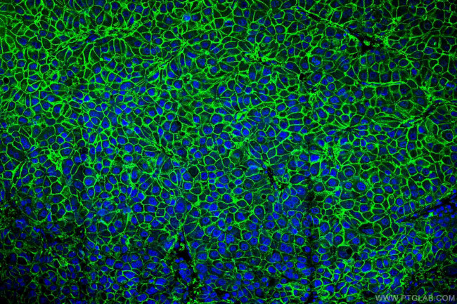 SLC31A1 Antibody in Immunohistochemistry (Paraffin) (IHC (P))