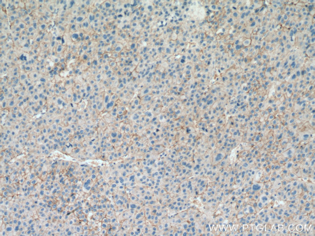 SLC31A1 Antibody in Immunohistochemistry (Paraffin) (IHC (P))