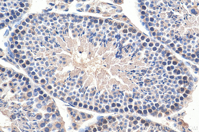 XRCC3 Antibody in Immunohistochemistry (Paraffin) (IHC (P))