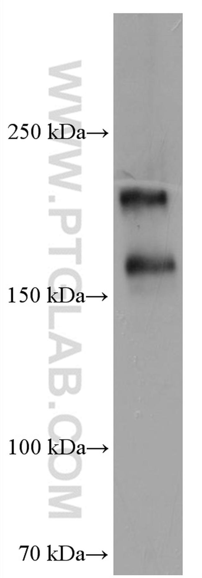 DUOX1 Antibody in Western Blot (WB)