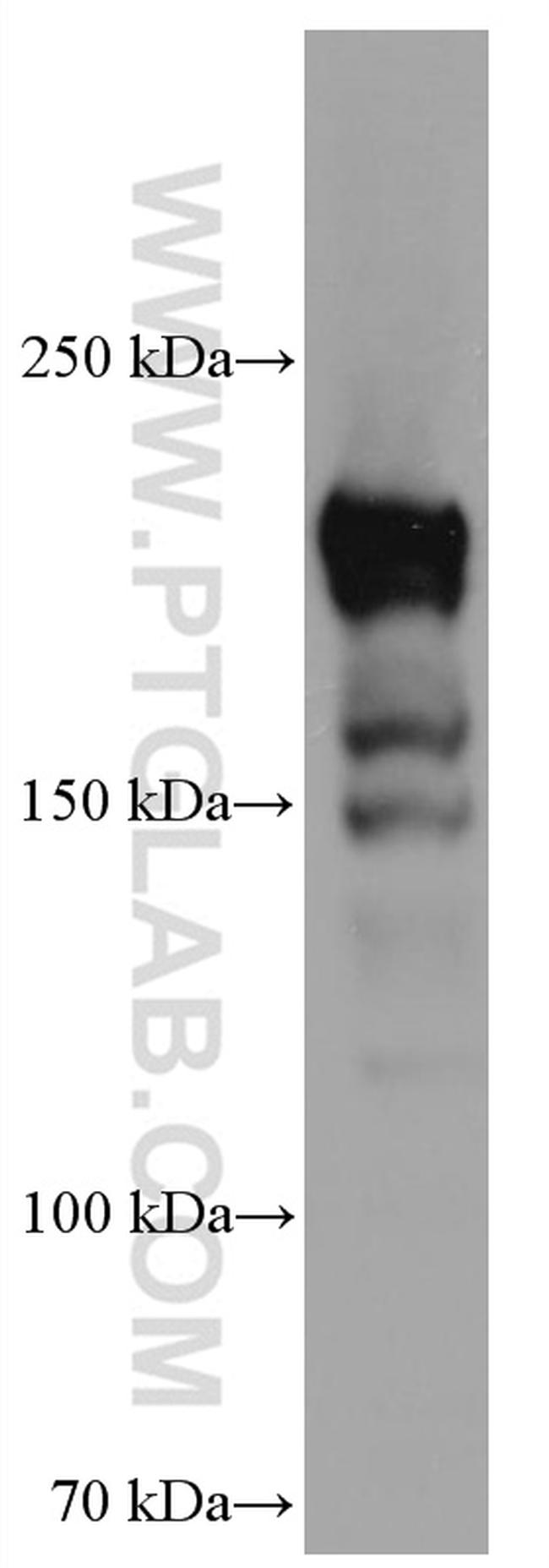 DUOX1 Antibody in Western Blot (WB)