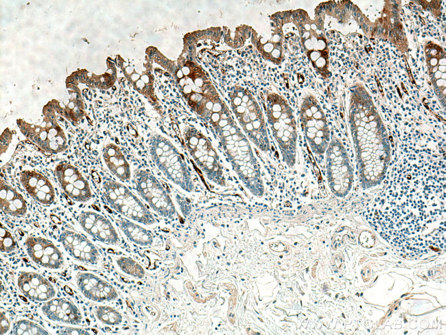 NQO1 Antibody in Immunohistochemistry (Paraffin) (IHC (P))