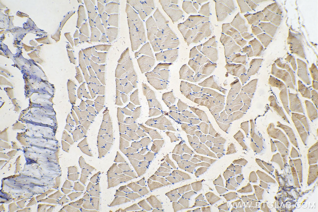 SERCA2/ATP2A2 Antibody in Immunohistochemistry (Paraffin) (IHC (P))