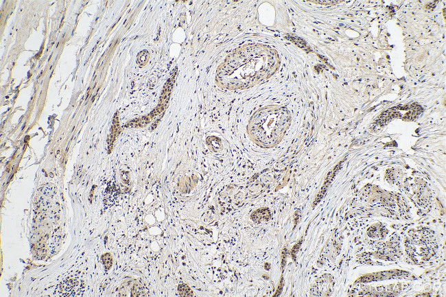 SERCA2/ATP2A2 Antibody in Immunohistochemistry (Paraffin) (IHC (P))