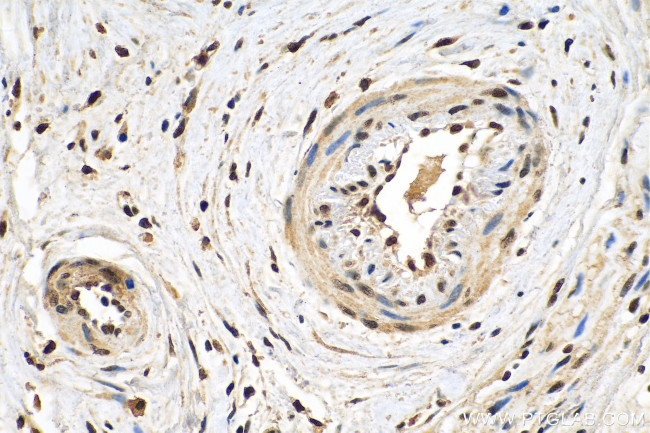 SERCA2/ATP2A2 Antibody in Immunohistochemistry (Paraffin) (IHC (P))