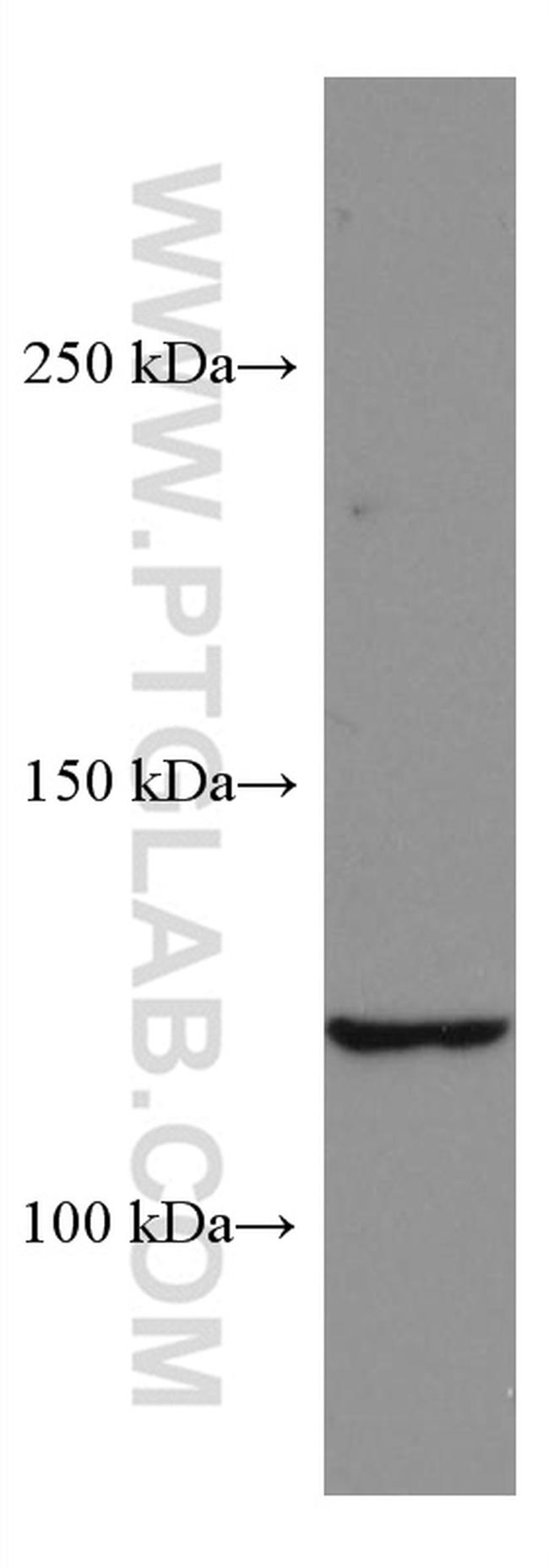 SERCA2/ATP2A2 Antibody in Western Blot (WB)