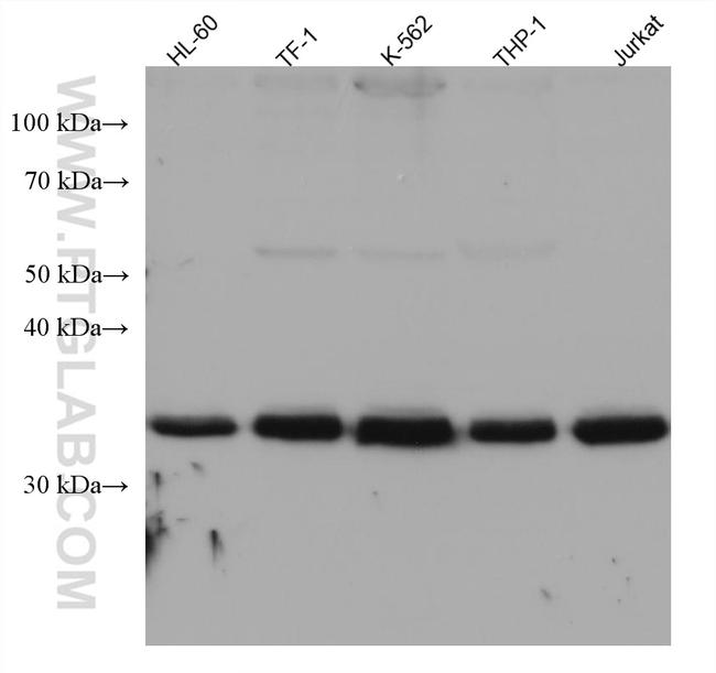 ULBP2 Antibody in Western Blot (WB)