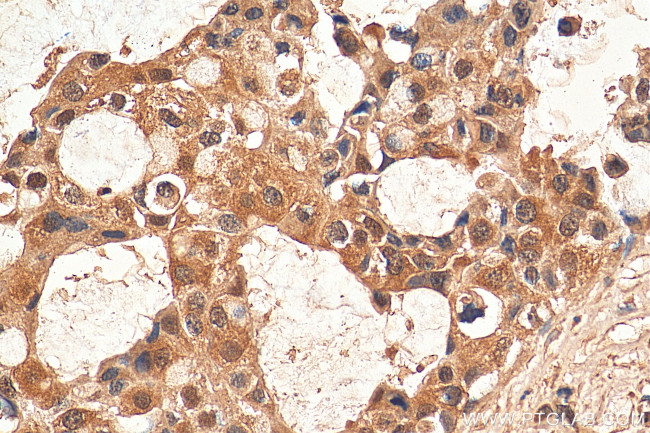 HDAC6 Antibody in Immunohistochemistry (Paraffin) (IHC (P))