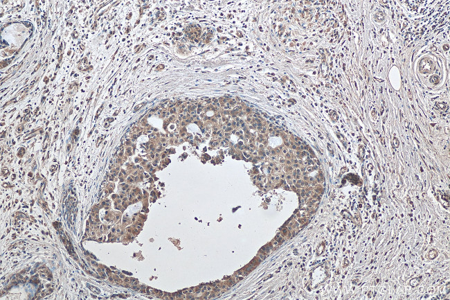 HDAC6 Antibody in Immunohistochemistry (Paraffin) (IHC (P))