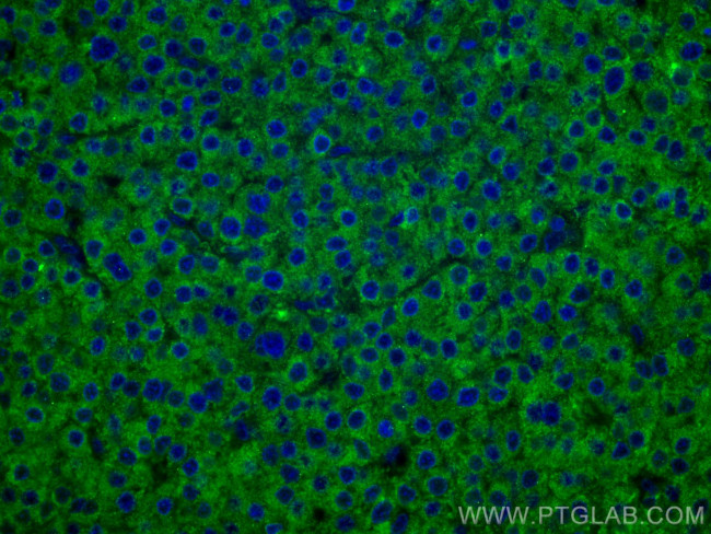 FUCA1 Antibody in Immunohistochemistry (Paraffin) (IHC (P))