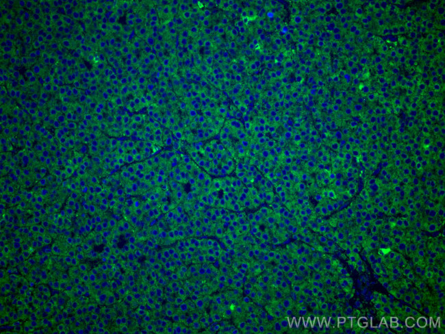 FUCA1 Antibody in Immunohistochemistry (Paraffin) (IHC (P))