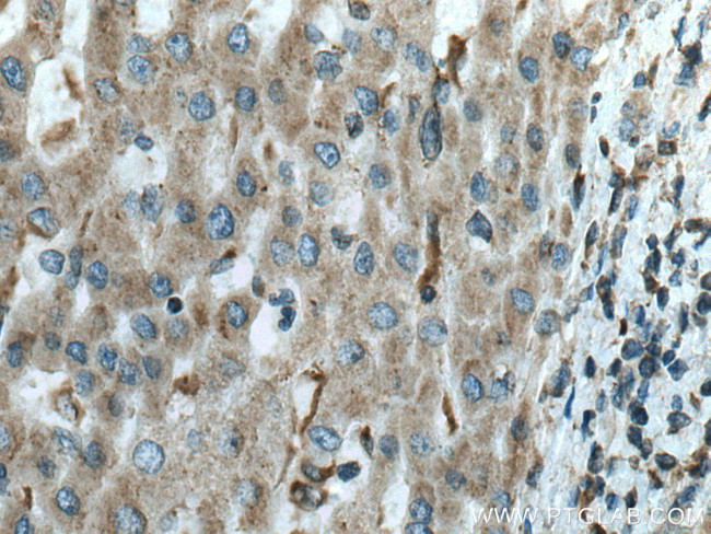 FUCA1 Antibody in Immunohistochemistry (Paraffin) (IHC (P))