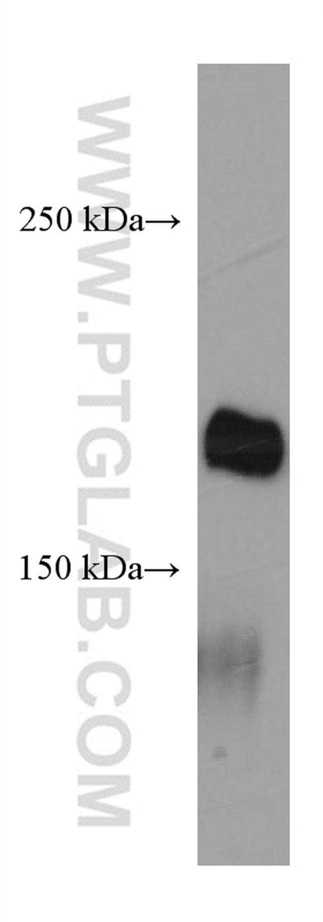 LAMC3 Antibody in Western Blot (WB)