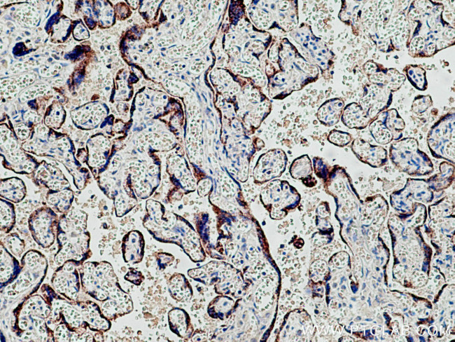 CYP11A1 Antibody in Immunohistochemistry (Paraffin) (IHC (P))