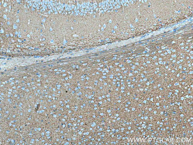 PLXNB2 Antibody in Immunohistochemistry (Paraffin) (IHC (P))