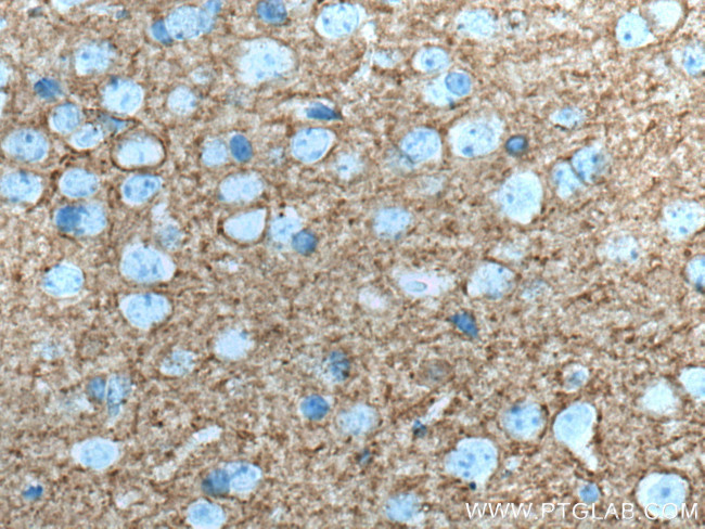 PLXNB2 Antibody in Immunohistochemistry (Paraffin) (IHC (P))