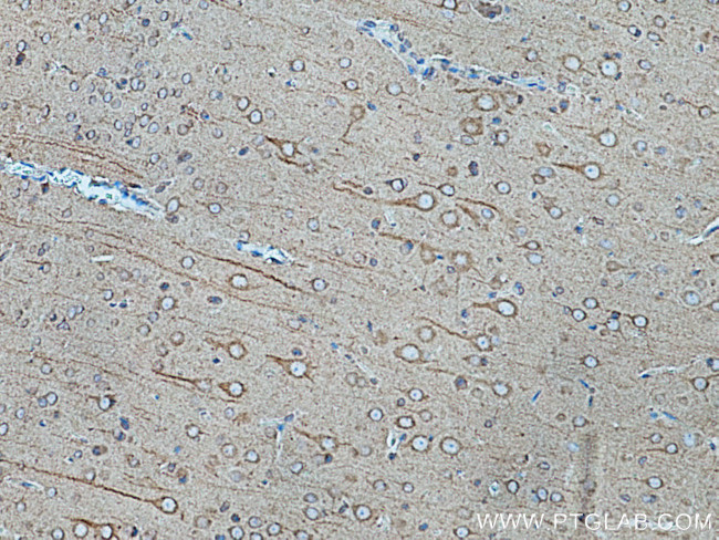 TRIM9 Antibody in Immunohistochemistry (Paraffin) (IHC (P))