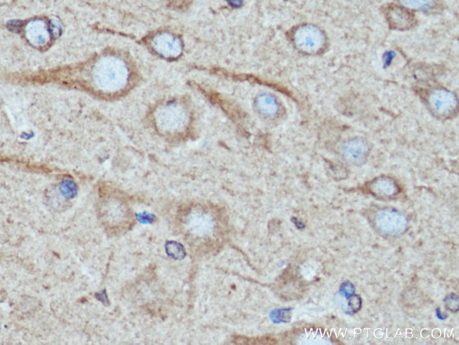 TRIM9 Antibody in Immunohistochemistry (Paraffin) (IHC (P))