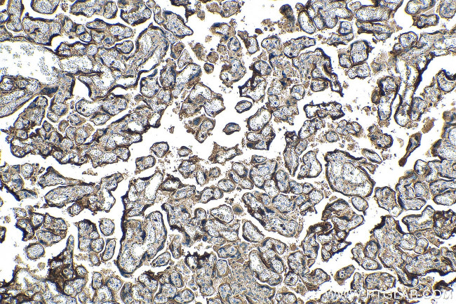 PSG1 Antibody in Immunohistochemistry (Paraffin) (IHC (P))