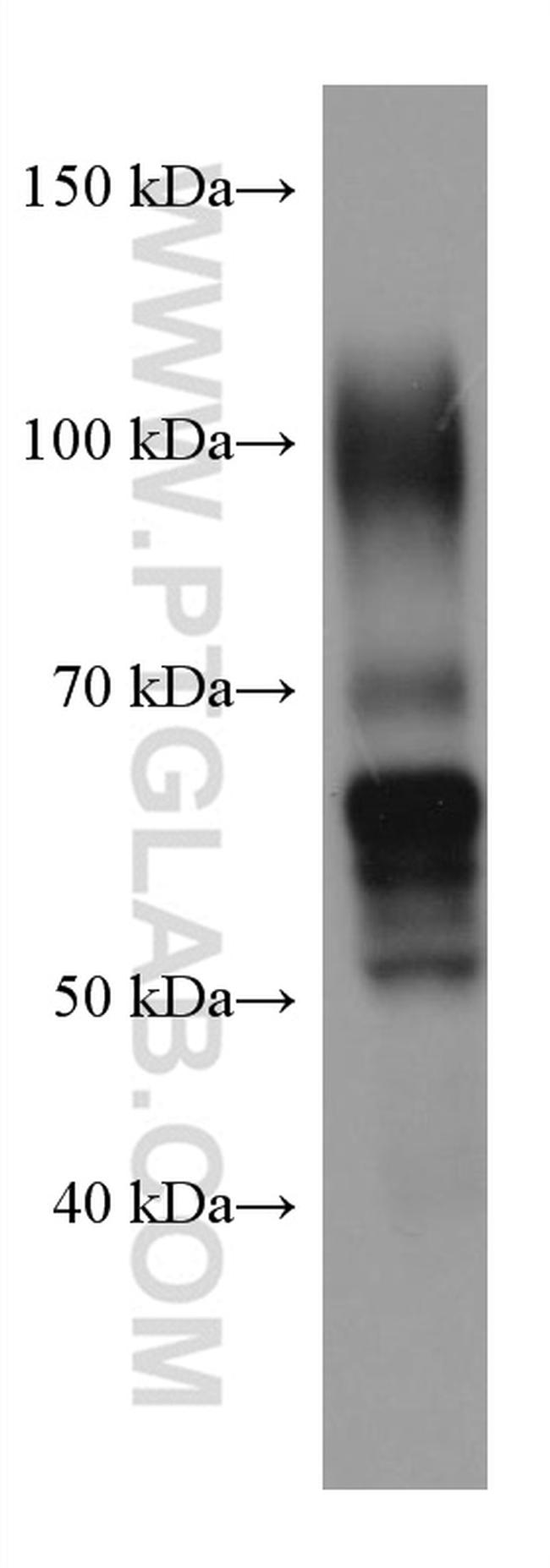 PSG1 Antibody in Western Blot (WB)