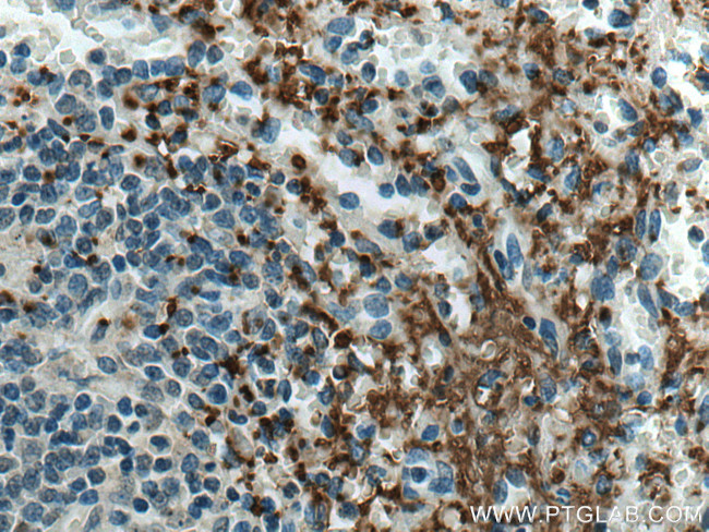 GP9 Antibody in Immunohistochemistry (Paraffin) (IHC (P))