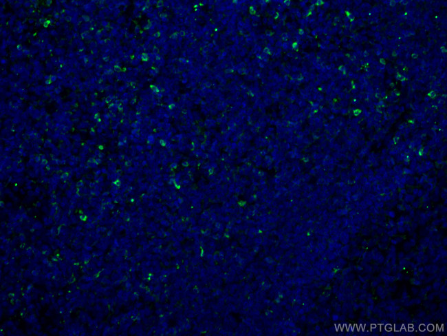 Granzyme K Antibody in Immunohistochemistry (Paraffin) (IHC (P))