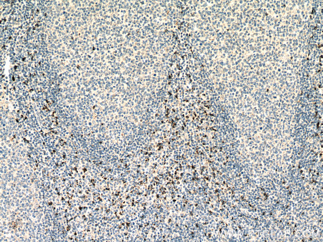 Granzyme K Antibody in Immunohistochemistry (Paraffin) (IHC (P))