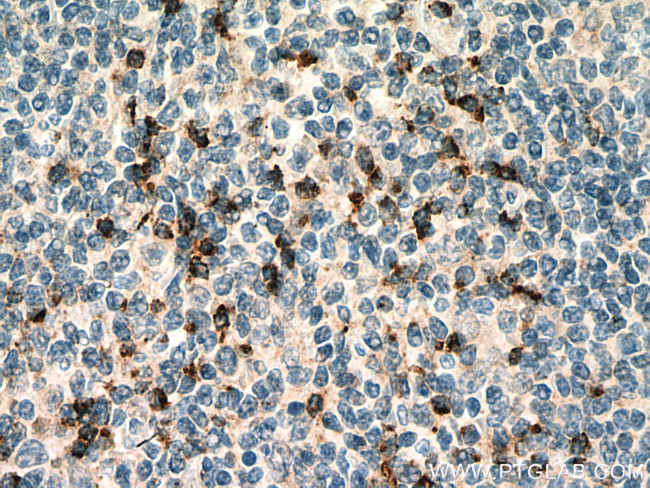 Granzyme K Antibody in Immunohistochemistry (Paraffin) (IHC (P))