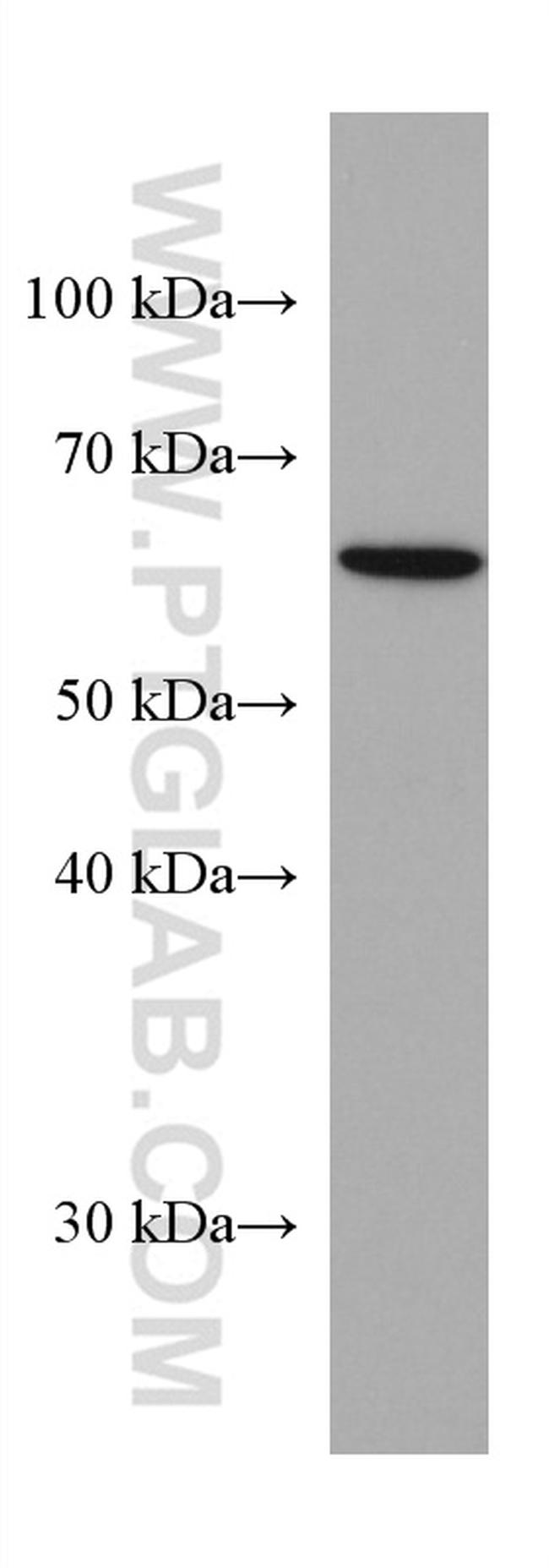 VANGL2 Antibody in Western Blot (WB)