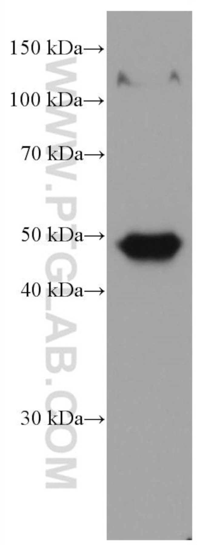 Biglycan Antibody in Western Blot (WB)