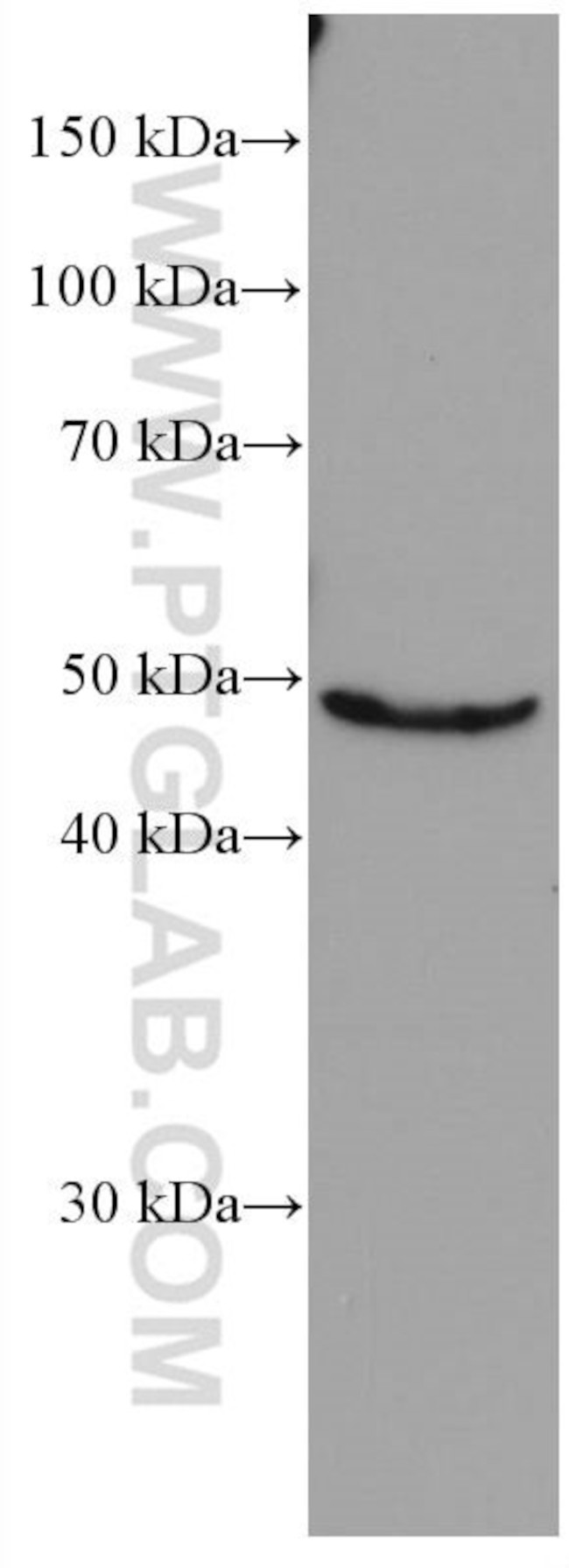 Biglycan Antibody in Western Blot (WB)